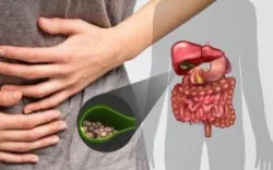 Sỏi túi mật gây ra nhiều biến chứng nguy hiểm nếu không phát hiện kịp thời -  Bệnh viện Việt Đức