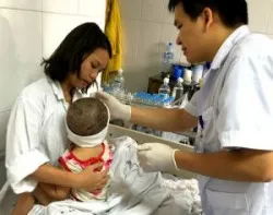 Ca mổ dưới kính hiển vi ghép nối da đầu cho bé gái 2 tuổi - Bệnh viện Việt Đức