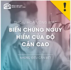 THOÁI HOÁ VÕNG MẠC BIẾN CHỨNG NGUY HIỂM CỦA ĐỘ CẬN CAO