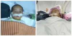 Liên tiếp trẻ nhập viện do ngộ độc chì từ thuốc cam - Bệnh viện nhi Trung Ương