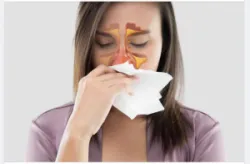 TÌM HIỂU KỸ THUẬT CHẨN ĐOÁN BỆNH MŨI XOANG TẠI MEDLATEC