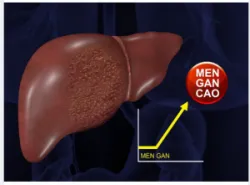 TUYỆT CHIÊU SỐNG KHỎE KHI CHỈ SỐ MEN GAN CAO