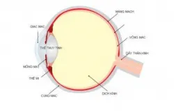 Ghép giác mạc - Bệnh viện 108