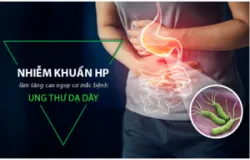 ƯU ĐIỂM CỦA TEST HP QUA HƠI THỞ, BẠN ĐÃ BIẾT CHƯA?