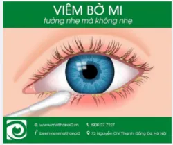 Viêm bờ mi: Tưởng nhẹ mà không nhẹ
