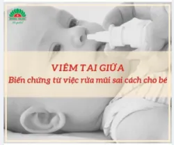 VIÊM TAI GIỮA - Biến chứng từ việc rửa mũi sai cách cho bé