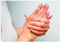XỬ TRÍ NHANH CHÓNG TỔN THƯƠNG DA DO LẠNH