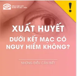 XUẤT HUYẾT DƯỚI KẾT MẠC CÓ NGUY HIỂM KHÔNG ?