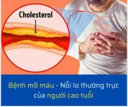 "GIẢI MÃ" NGUYÊN NHÂN VÀ CÁCH PHÒNG BỆNH MỠ MÁU Ở NGƯỜI CAO TUỔI