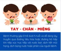 TRẺ MẮC TAY CHÂN MIỆNG TĂNG CAO - ĐÃ CÓ TRƯỜNG HỢP TỬ VONG