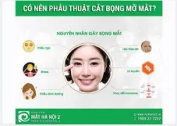 CÓ NÊN PHẪU THUẬT CẮT BỌNG MỠ MẮT?