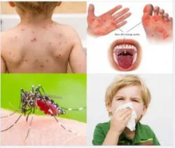 NHIỀU BỆNH GIAO MÙA ĐANG "NÓNG" - LÀM SAO ĐỂ BẢO VỆ SỨC KHỎE??
