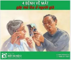 4 BỆNH VỀ MẮT GÂY MÙ LÒA Ở NGƯỜI GIÀ