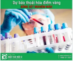 ĐỘT PHÁ: Dự báo thoái hóa điểm vàng bằng xét nghiệm máu