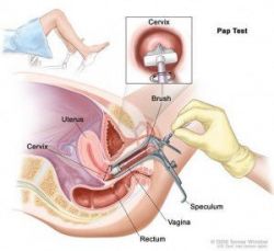 Những điều cần biết về vắc-xin HPV - Vắc-xin phòng ngừa ung thư cổ tử cung