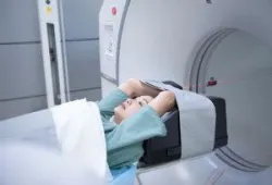 Rối loạn co giật cục bộ