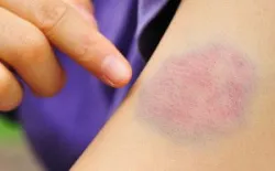Tế bào máu sinh ra ở đâu?