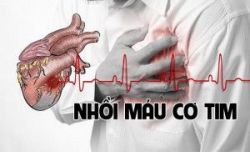 Các dấu hiệu sốc tim điển hình có thể nhận biết ngay