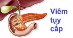 Viêm tụy mạn: Điều trị thế nào?