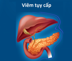 Một vài chỉ số xét nghiệm quan trọng trong chẩn đoán viêm tụy cấp