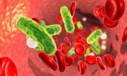 Định lượng Procalcitonin đánh giá sớm tình trạng nhiễm khuẩn và nhiễm khuẩn huyết