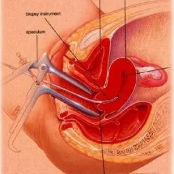 Xét nghiệm đánh giá miễn dịch tại niêm mạc tử cung khi IVF nhiều lần thất bại