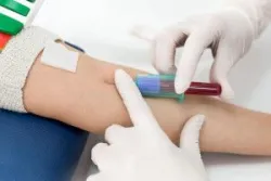 Những lưu ý khi xét nghiệm nồng độ AMH đánh giá khả năng dự trữ buồng trứng