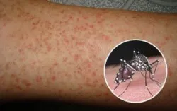 Vì sao virus có thể phát tán, lây từ người sang người?