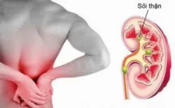 Vì sao sỏi mật thường gây viêm tụy cấp?
