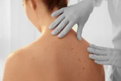 Ứng dụng PCR kỹ thuật số trong theo dõi điều trị ung thư không xâm lấn