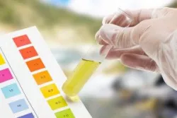 Xét nghiệm nước tiểu ở trẻ bị nhiễm trùng đường tiết niệu