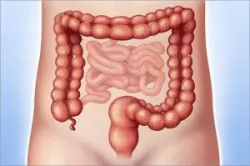 Tìm hiểu phương pháp nội soi cắt polyp đại tràng