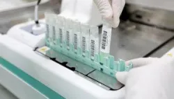 Xét nghiệm tìm máu ẩn trong phân được thực hiện trong trường hợp nào?