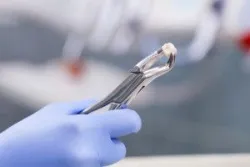 Làm thế nào để trị dứt điểm nhức răng sau sinh?