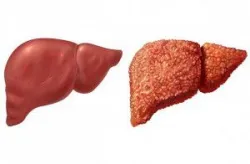Xét nghiệm độ thẩm thấu niệu chẩn đoán bệnh lý rối loạn điện giải của cơ thể