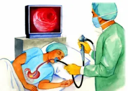 Tìm hiểu nội soi cầm máu điều trị chảy máu đường tiêu hóa