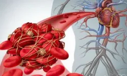 Xét nghiệm troponin T trong đánh giá suy tim, nhồi máu cơ tim