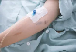 Tai biến thường gặp khi truyền máu và cách xử trí