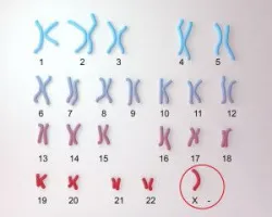 Ứng dụng của microarray trong trường hợp sảy thai liên tiếp