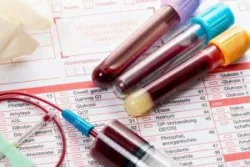 Hướng dẫn đọc kết quả xét nghiệm Progesterone