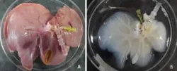 Điều trị ngộ độc nấm độc