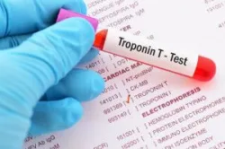 Đặc điểm và điều trị nhồi máu cơ tim type 2