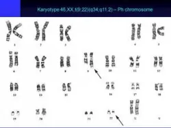 Xét nghiệm công thức nhiễm sắc thể