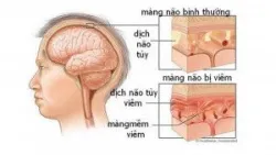 3 chức năng của dịch não tủy