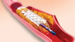 Giải phẫu mạch máu chi dưới