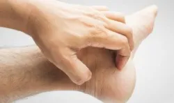 Bàn chân nói gì về sức khỏe của bạn?