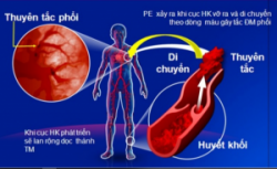 Sự thay đổi của cơ thể khi gây mê toàn thân