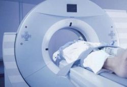 Tìm hiểu cách Chụp cắt lớp vi tính động mạch chi dưới