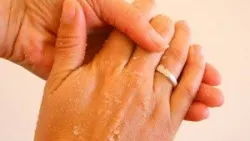 7 mẹo để giữ da tay khỏe mạnh khi rửa tay thường xuyên