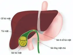 Lợi ích sức khỏe của cà phê và trà